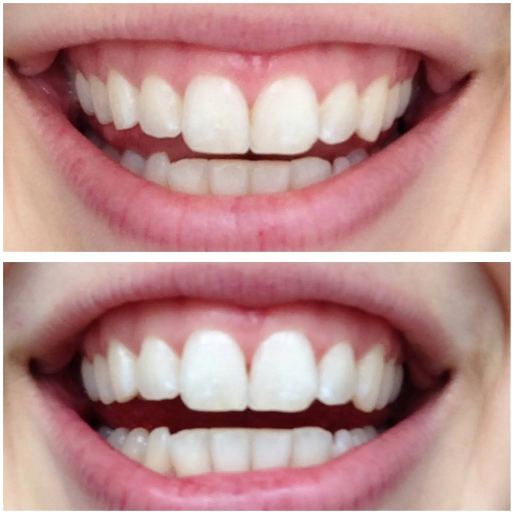 Bold Charcoal Teeth Whitening Powder