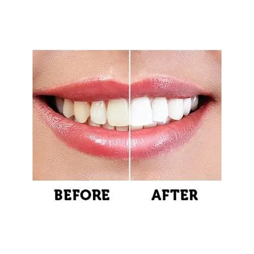 Bold Charcoal Teeth Whitening Powder